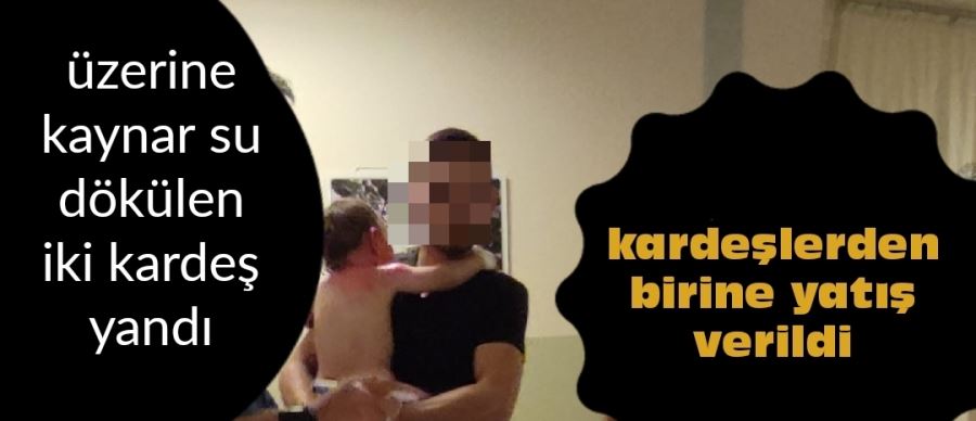 Ikiz kardeşlerin üzerine kaynar su döküldü