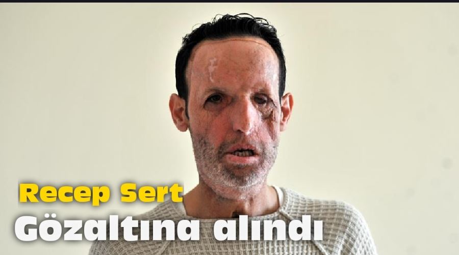 Recep Sert gözaltına alındı 