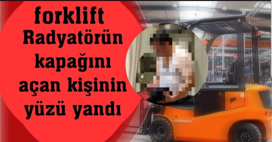 Radyatörün kapağını açan kişinin yüzü yandı