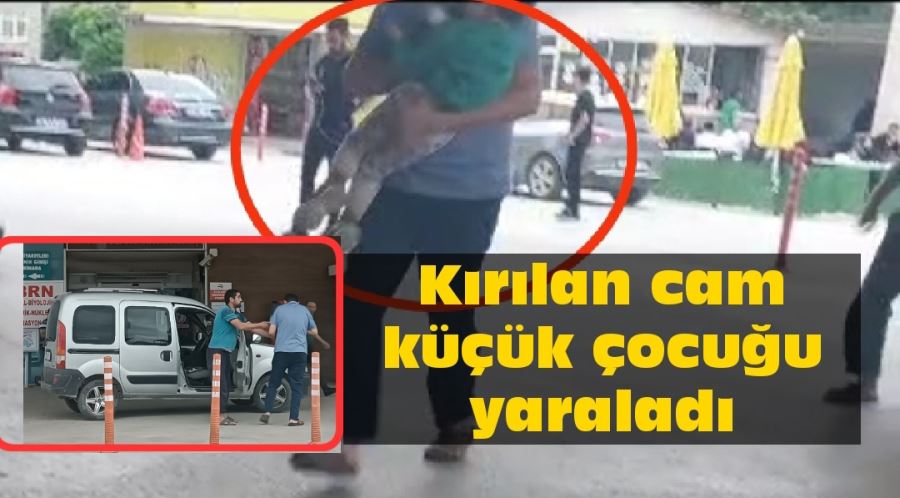 Kırılan cam küçük çocuğu yaraladı