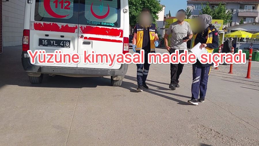 Yüzüne kimyasal madde sıçradı