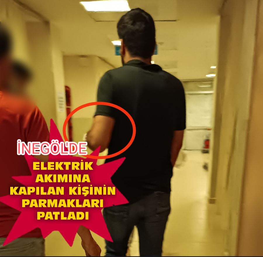 Elektrik çarpması, parmakları patladı