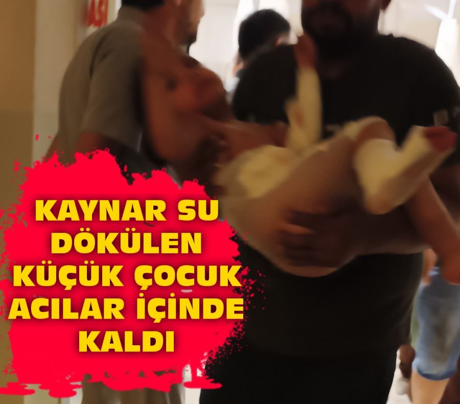 KAYNAR SU DÖKÜLEN KÜÇÜK ÇOCUK ACILAR İÇİNDE KALDI