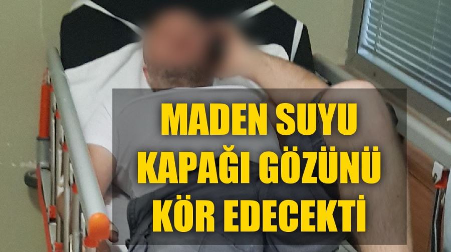 MADEN SUYU KAPAĞI GÖZÜNÜ KÖR EDECEKTİ!