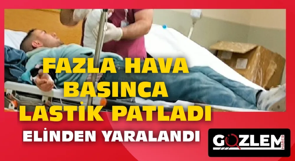 FAZLA BASINÇTAN LASTİK PATLADI ELİ YARALANDI